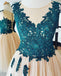 Teal Lace Applique Stunning Cheap Homecoming Dresses Online, BDY0356